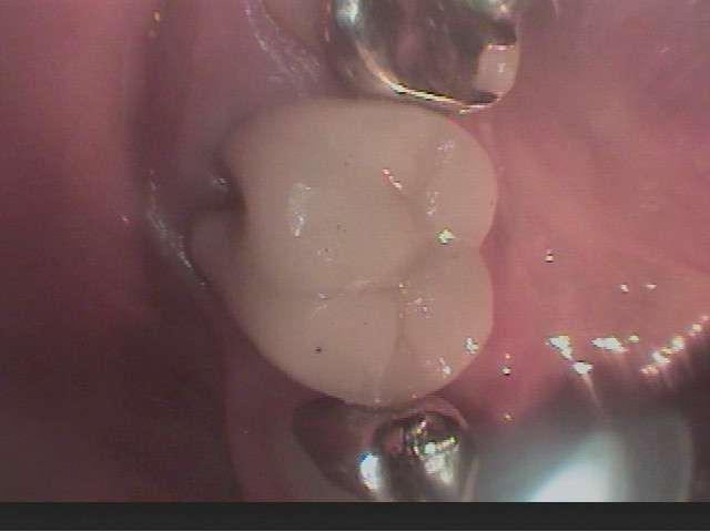 4cKFaD5fT0SZ5Mu4phYyaKJ4Yk7hedcv