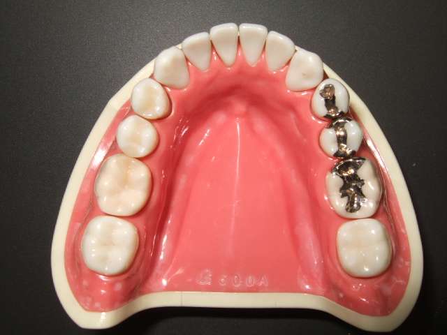 FRQtY3SEd7bgcjvzyeZFsv1pqbF6vCfz