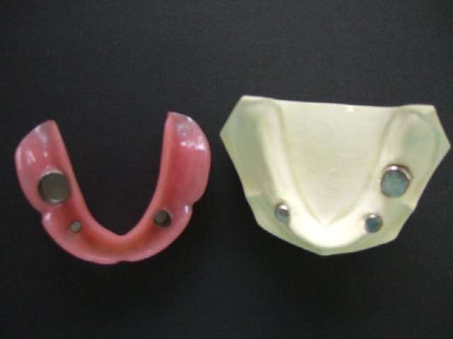 JtechkCwb1vwyAW9Cdv4XEAfXe02rh7S