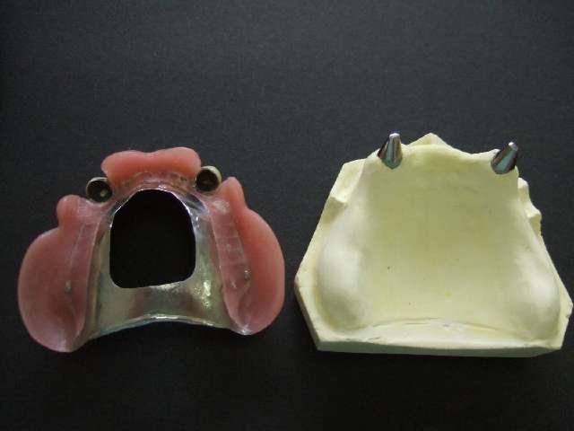 jSVGD5U3c6622SzruvHmTpqFqg5WncfN