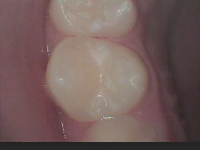 4ta6jENBaX35gA9q4teniQIit9Z6g0Ki