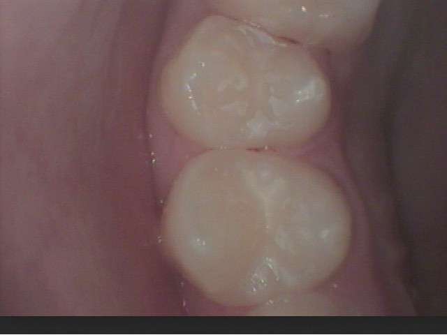 irndIvDgifc0E6vnwG9JvfPnkU9zdfue