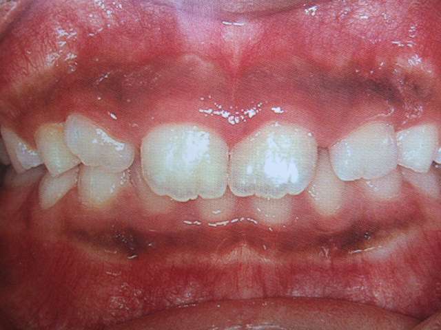 P65ck6BEn6145rhAd20tvbtD8mvGAs5n