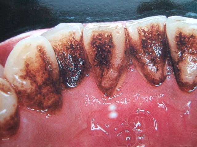 eu7294crnqnFG17dj71nDuXiUKffj0Fq