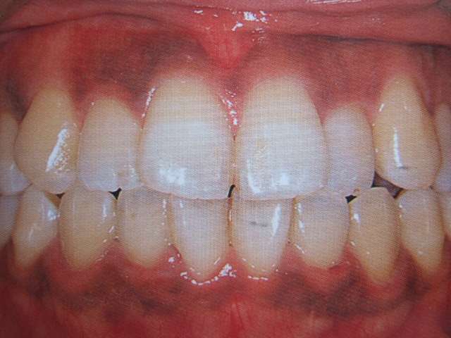 A6j9NuveENXhjjWvwKFmgjAj4Evdsm00