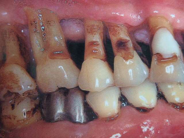 9eaBCa2c4jPvx1HAhAdgT7BFcF3yjVmc