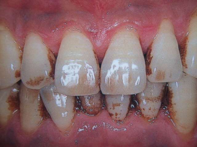 f3J2cUAgcHRGyE4sUGHR8udHQm8FP9dE